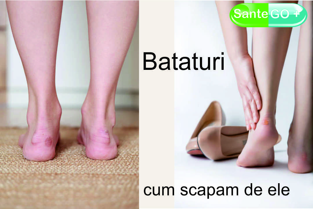 Read more about the article <strong>Bataturi</strong>