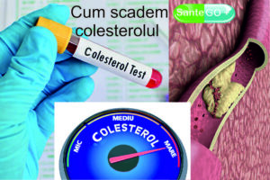 Read more about the article <strong>Cum scadem colesterolul</strong>